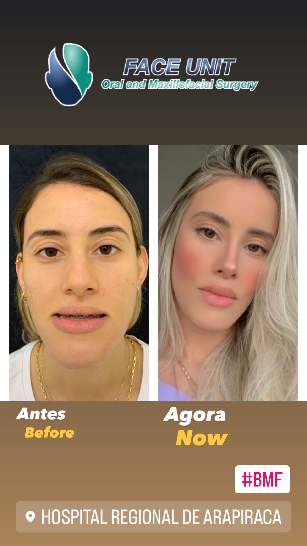 Ortognática