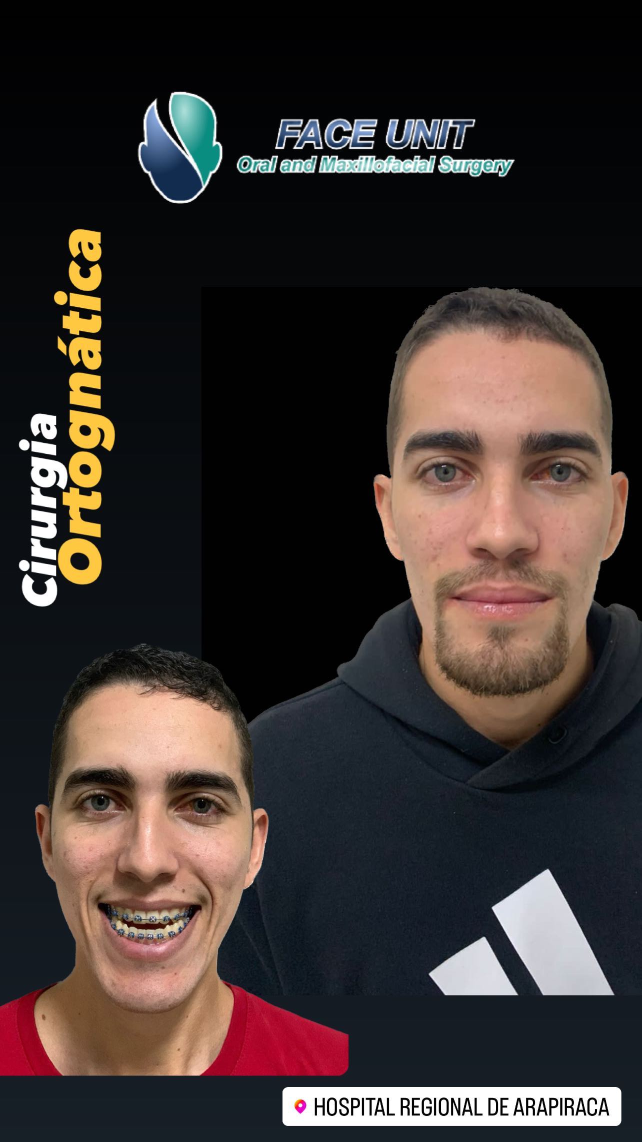 Ortognática Caso