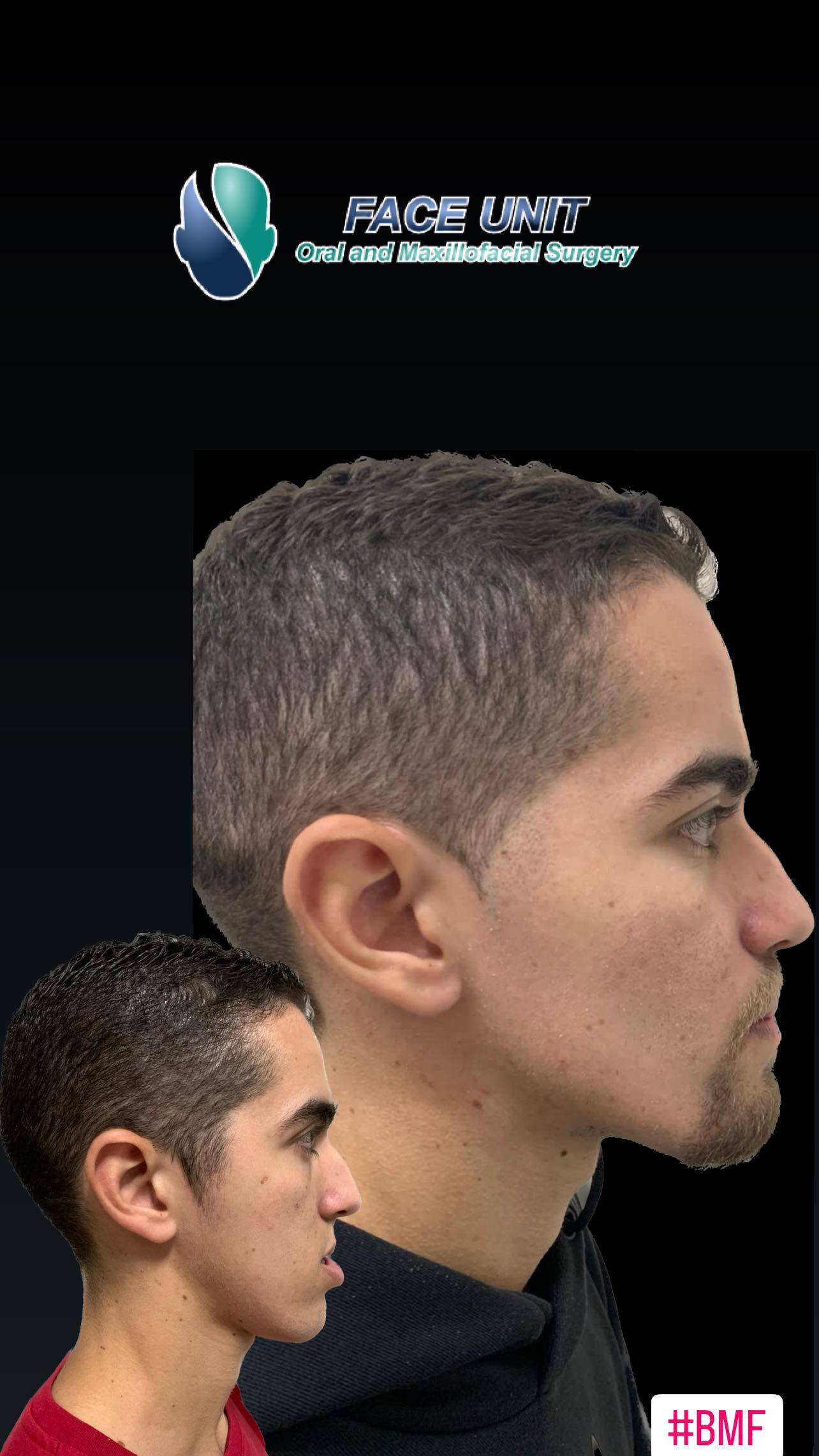 Ortognática Caso