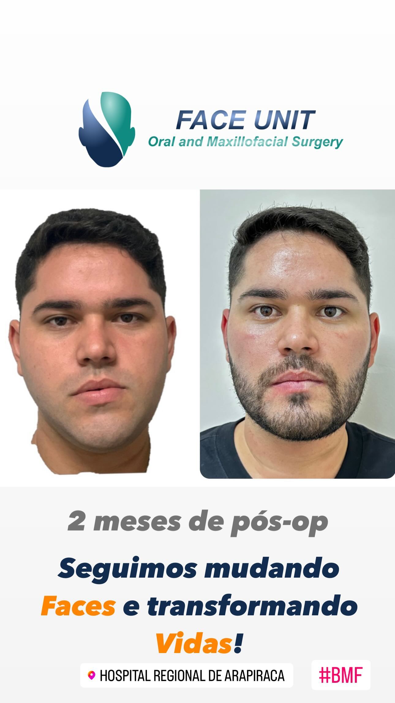 Ortognática Caso