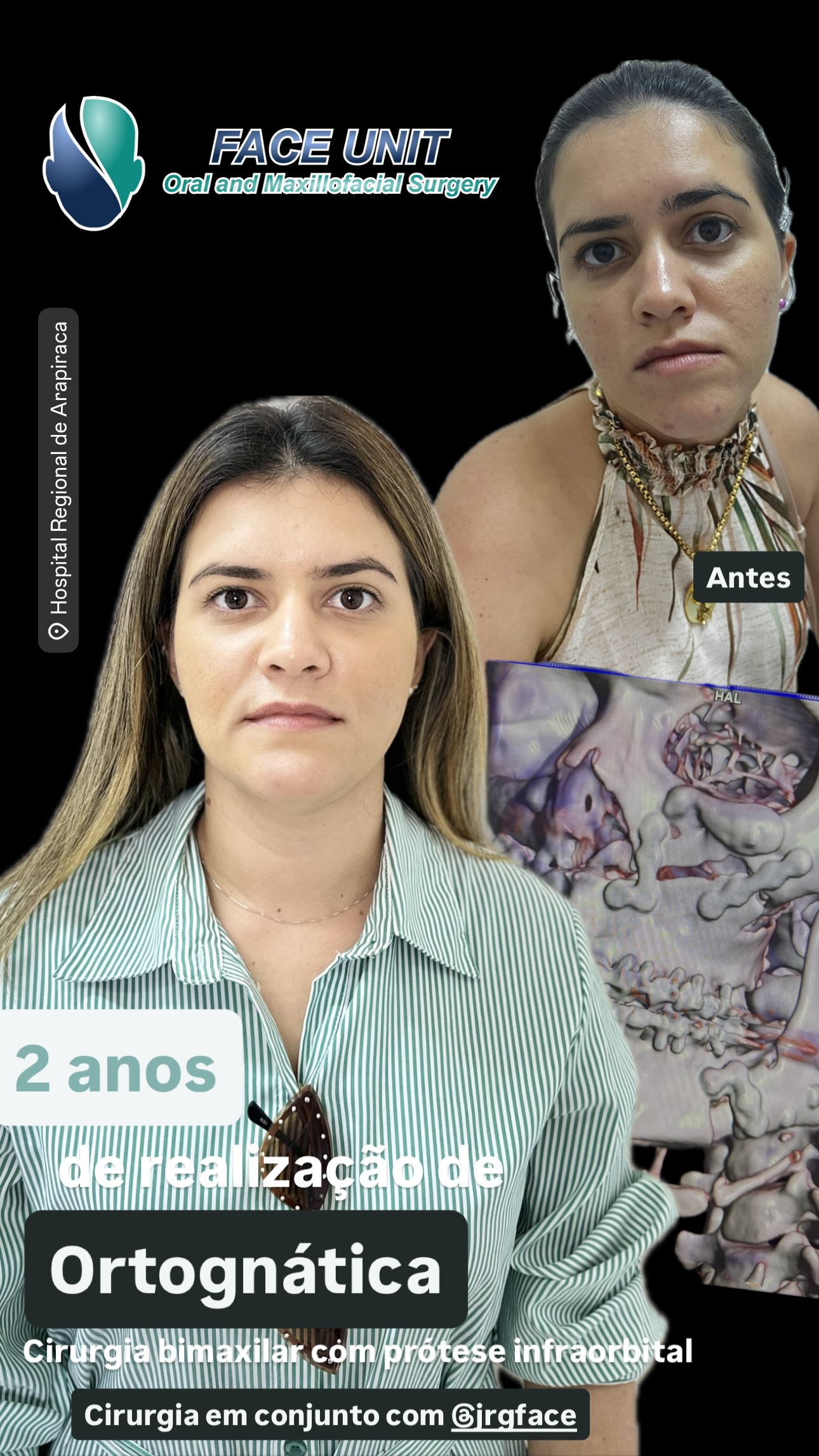 Ortognática Caso
