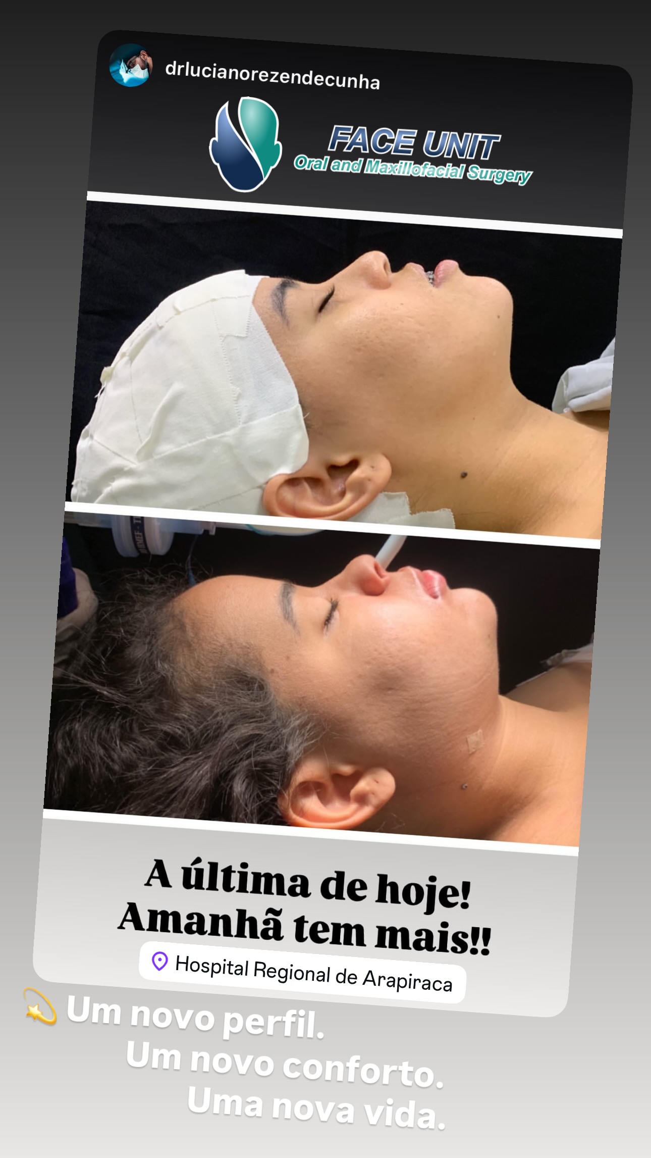 Ortognática Caso