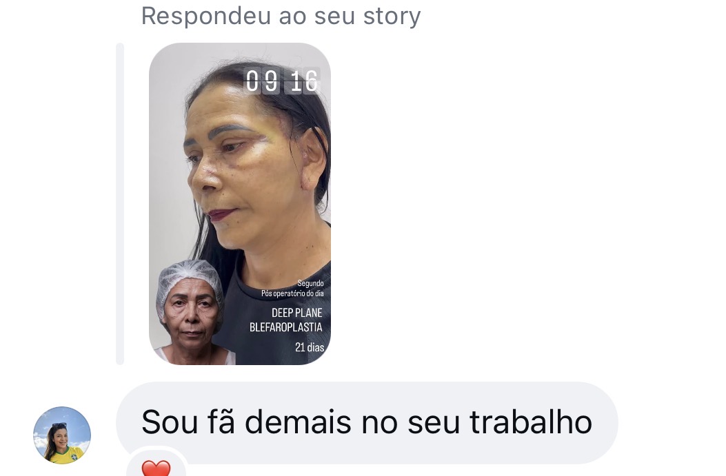 Feedback